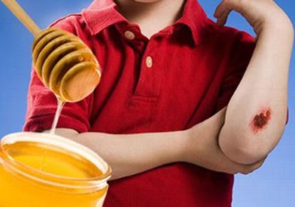 Sát trùng và làm dịu vết thương