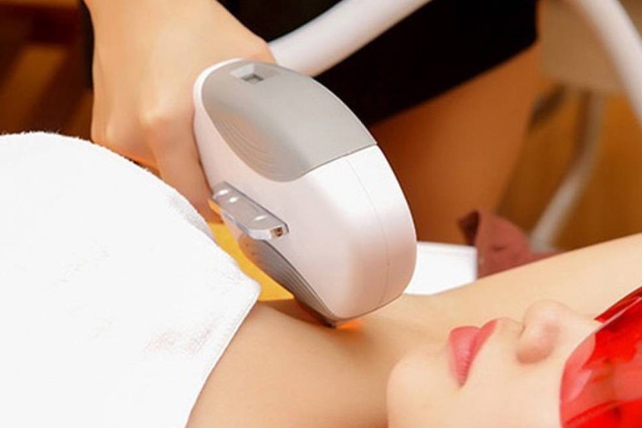 Công nghệ triệt lông mới nhất 4