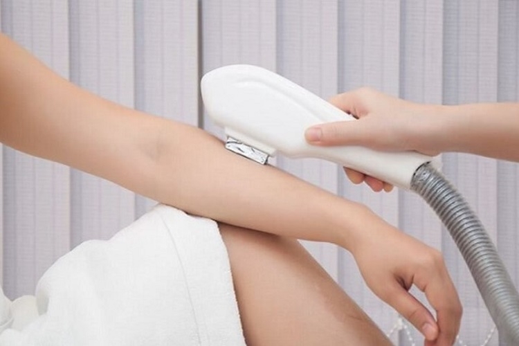 Công nghệ triệt lông mới nhất 5