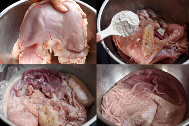 dạ dày hấp tiêu - ảnh 2