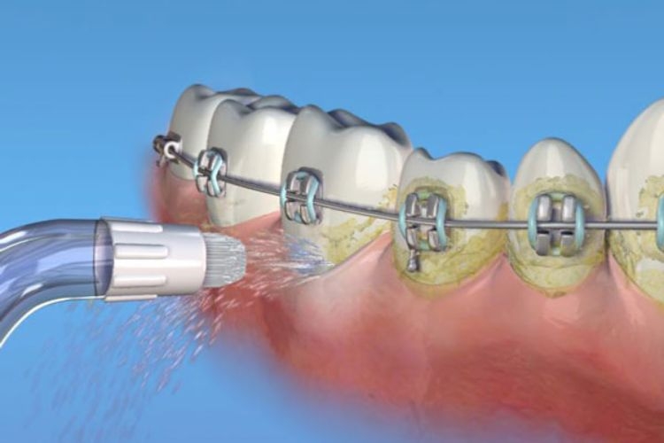 Vì sao cần biết cách sử dụng tăm nước?