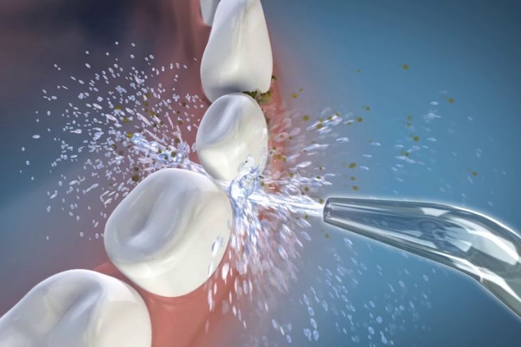 Tại sao nên sử dụng tăm nước?