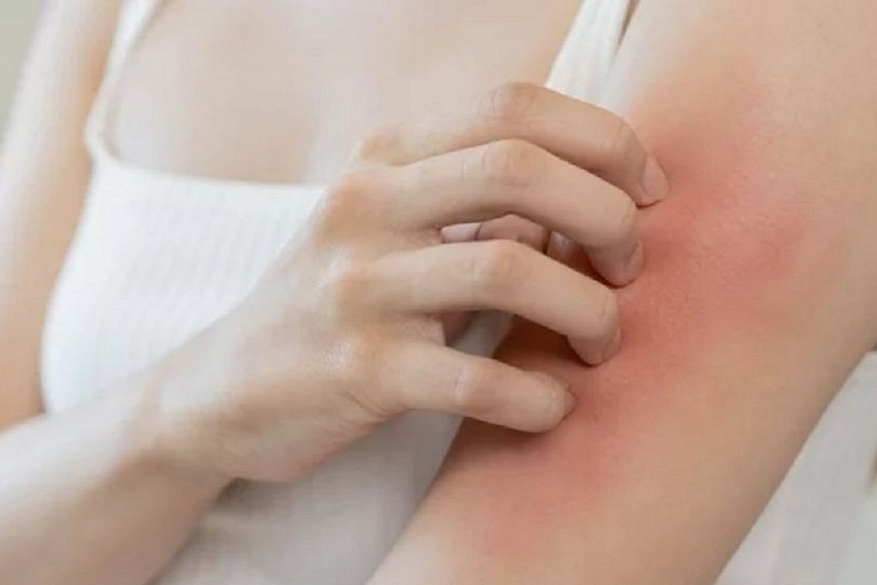 Tinh dầu tỏi 4