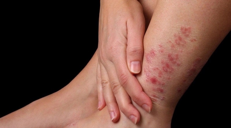 cách ăn mù tạt không bị sặc 10