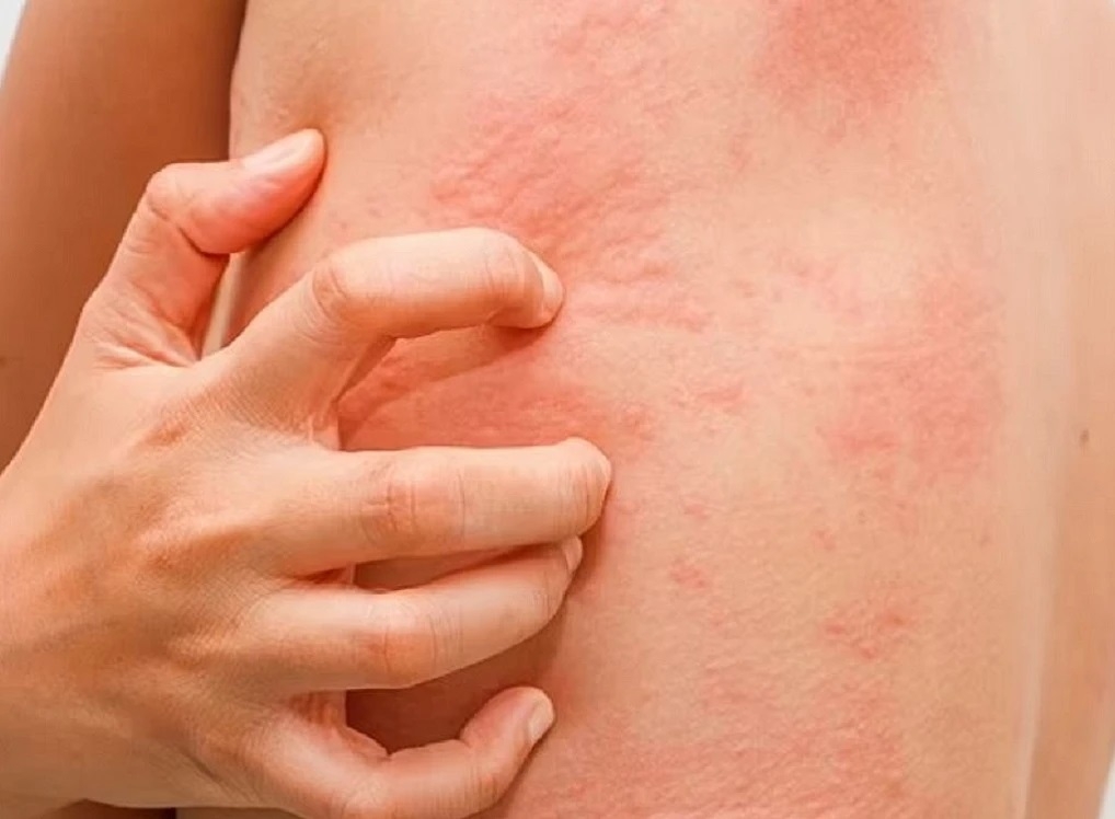 cách ăn mù tạt không bị sặc 16