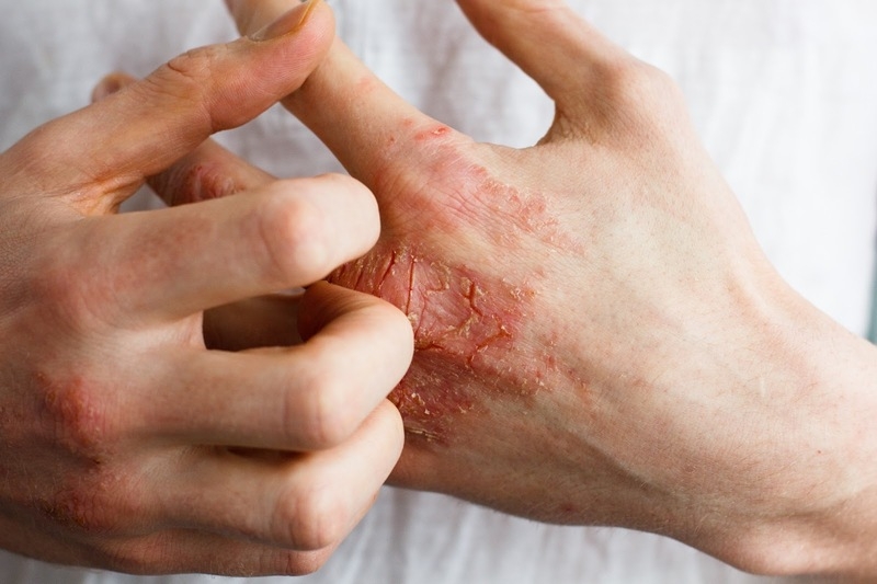 cách ăn mù tạt không bị sặc 3
