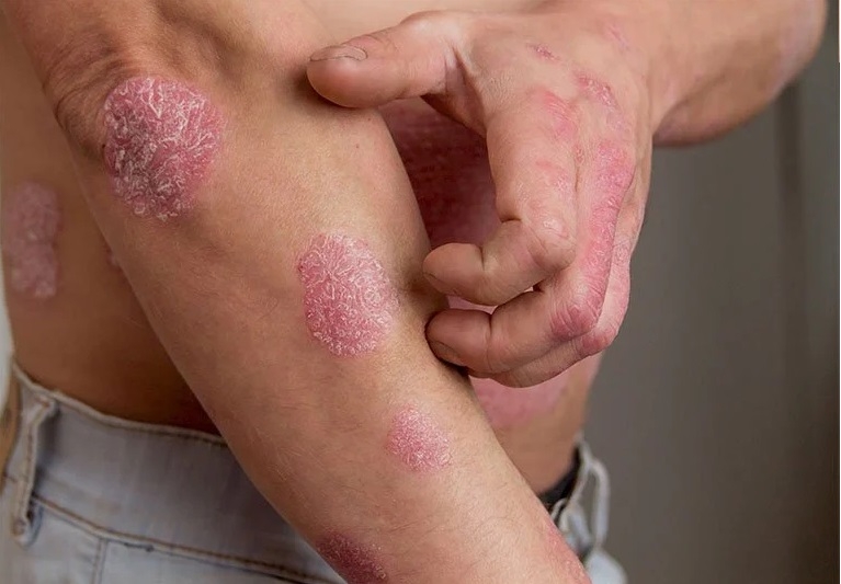 cách ăn mù tạt không bị sặc 9