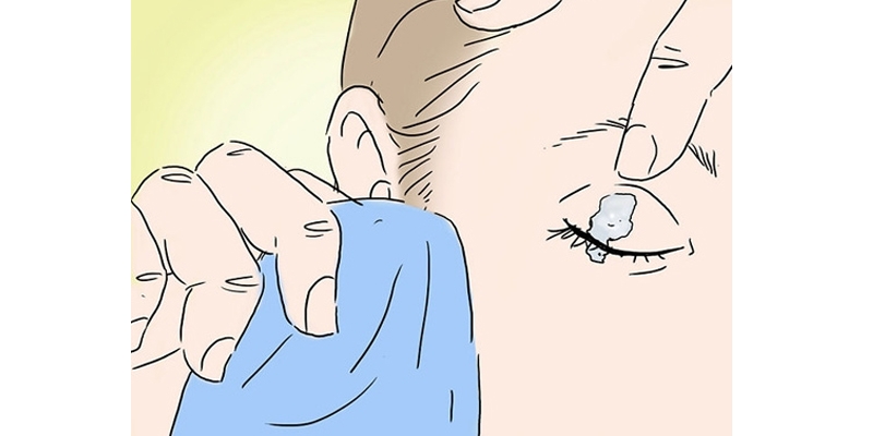 Giải pháp tẩy keo 502 dính vào tay một cách an toàn và hiệu quả-h7