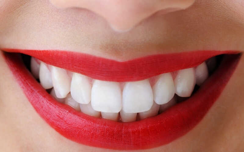Không còn lo ngại răng ố vàng với 7 loại kem đánh răng làm trắng răng hiệu quả-h1