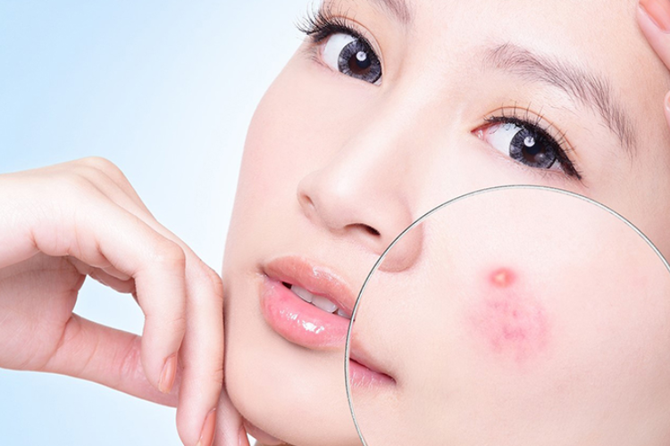 Bột khoai tây là gì? Hé lộ công dụng và ứng dụng của bột khoai tây trong cuộc sống hàng ngày mà không phải ai cũng biết hình 3