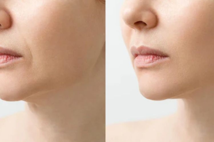 lợi ích của công nghệ Ion Galvanic