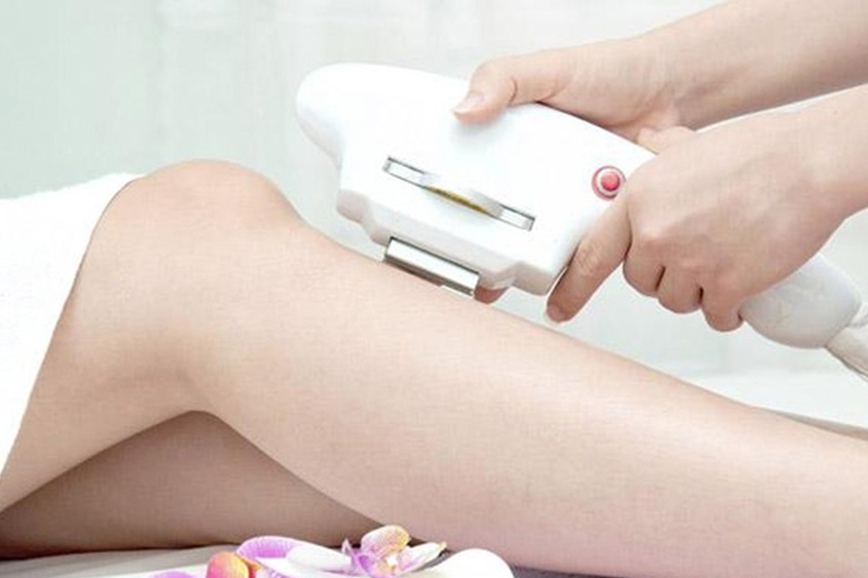 Máy triệt lông ứng dụng công nghệ RF.