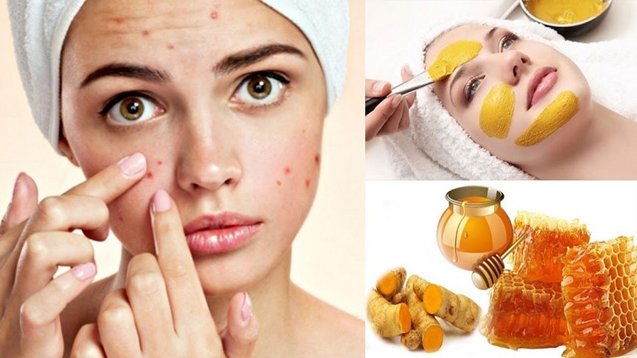 Nghệ ngâm mật ong có tác dụng gì? 5