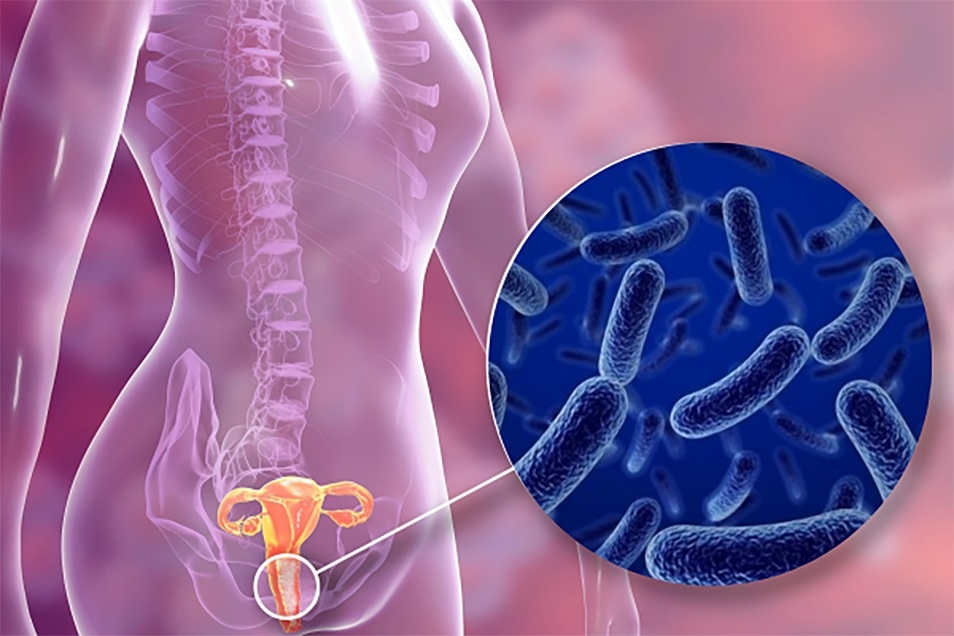 Probiotic - 5 tác dụng tuyệt vời cho chị em phụ nữ, bổ sung sao cho hiệu quả? 3