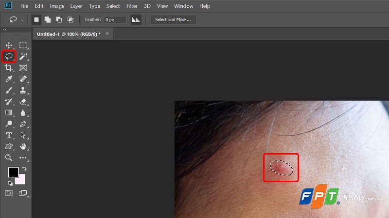 Cách xóa mụn trong Photoshop - hình 11