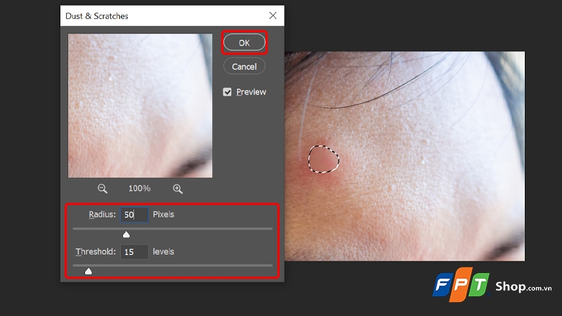 Cách xóa mụn trong Photoshop - hình 4