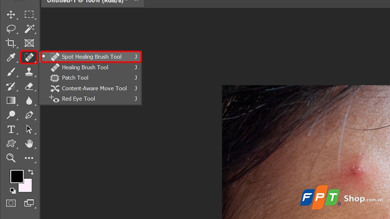 Cách xóa mụn trong Photoshop - hình 5