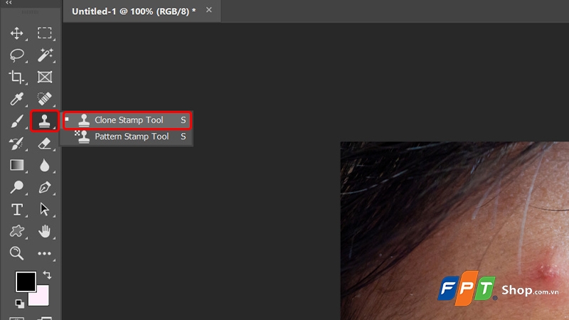 Cách xóa mụn trong Photoshop - hình 8