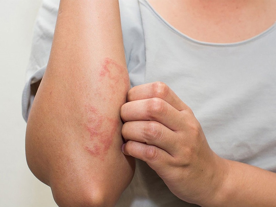 Uống nước kiềm bị ngứa có nguyên nhân do đâu? Những lợi ích khi dùng nước kiềm đúng cách 2