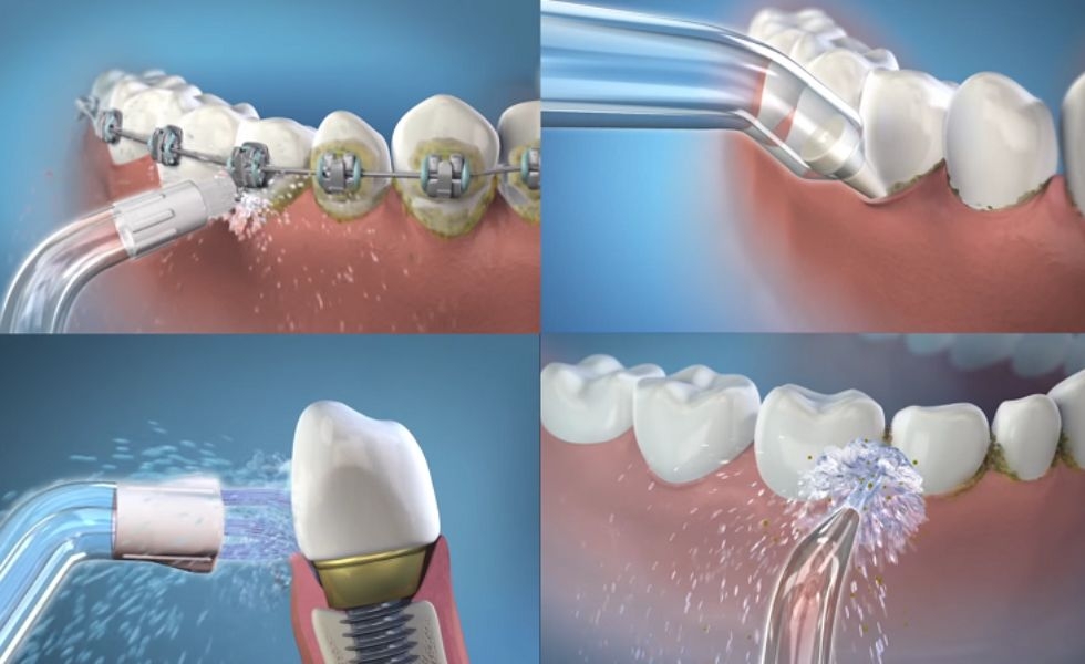 máy tăm nước dành cho ai