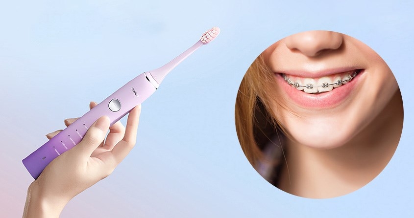 niềng răng có nên dùng bàn chải điện không? 3