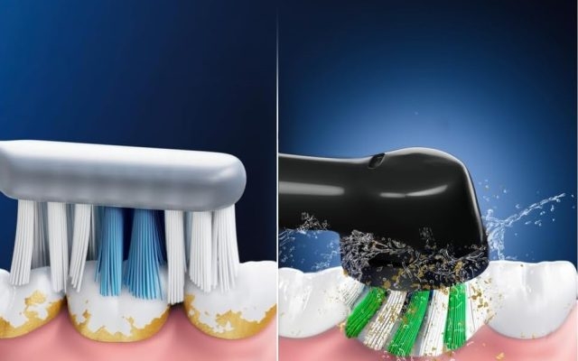 bàn chải điện công nghệ 3D 2