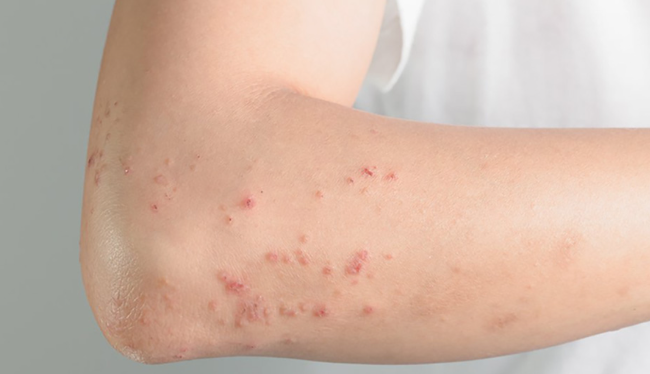 Nguyên nhân nước nhiễm phèn  5