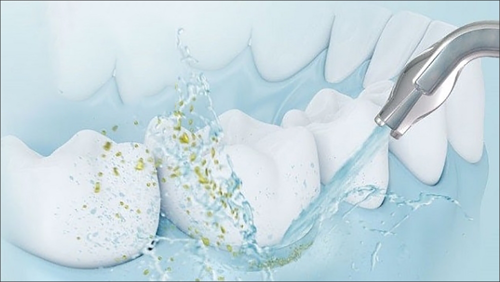 Công nghệ sóng siêu âm của máy tăm nước