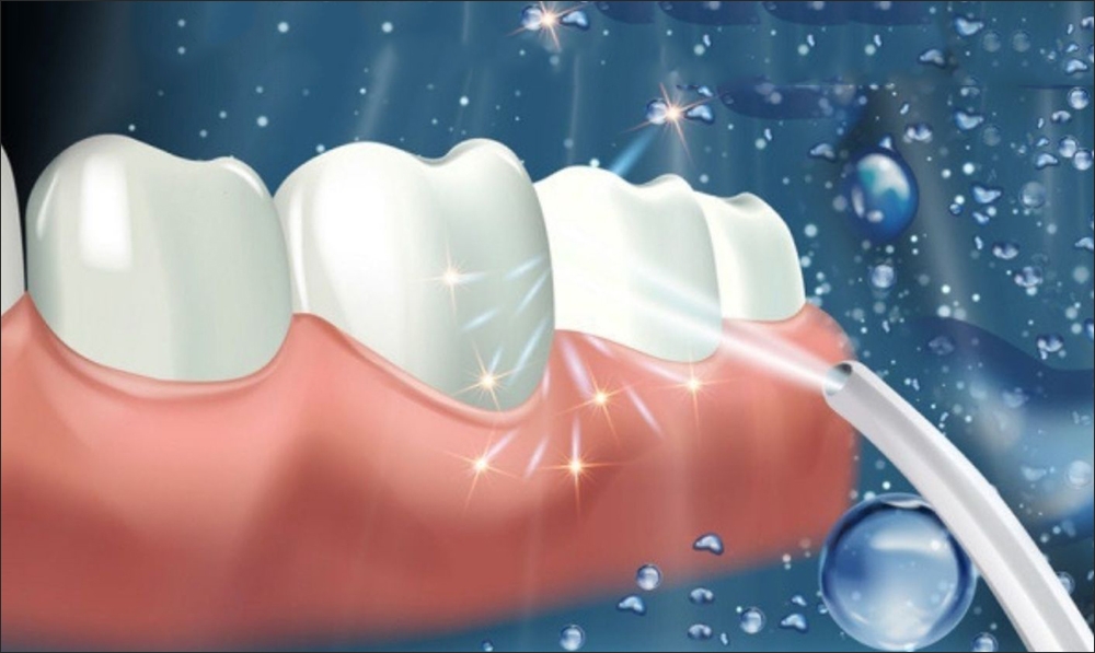 Công nghệ massage nướu của máy tăm nước