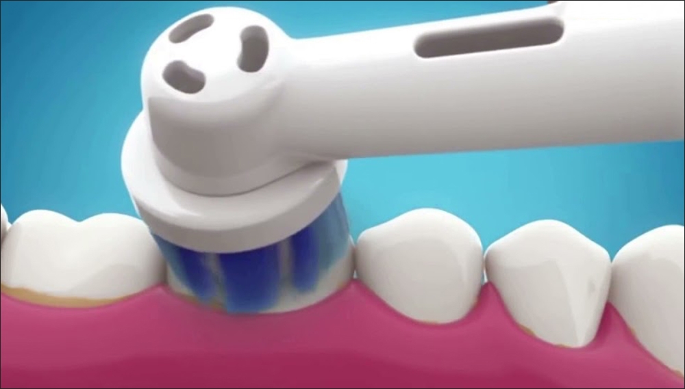 Bàn chải điện công nghệ 2D là gì?