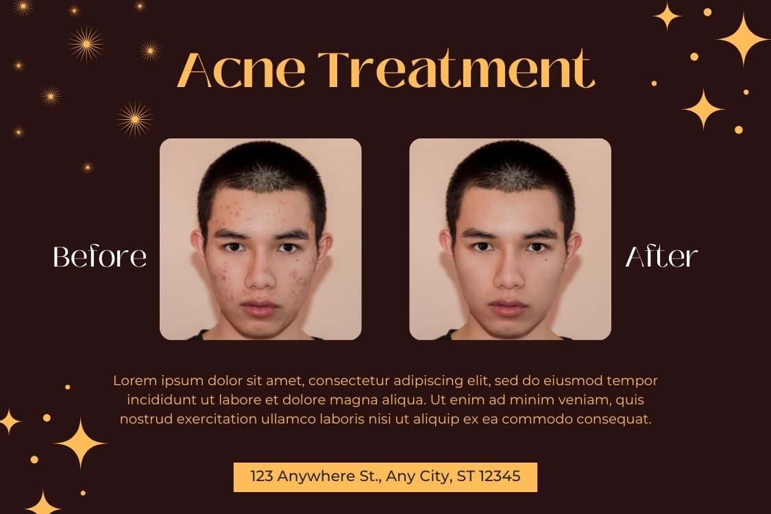 Lỗi so sánh trước sau trong quảng cáo Facebook Ads