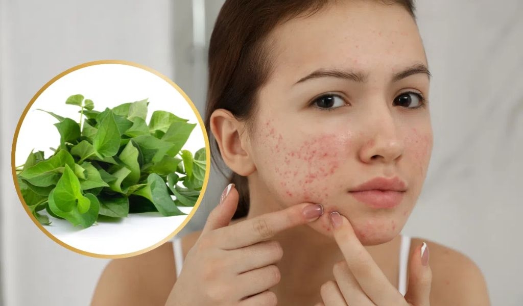 Cách làm mặt nạ rau diếp cá để tủ lạnh tươi lâu và lưu ý khi sử dụng đảm bảo an toàn 2