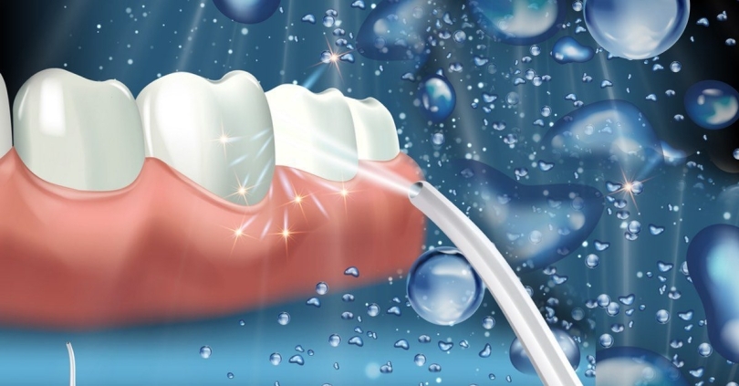 kinh nghiệm mua máy tăm nước (ảnh 4)