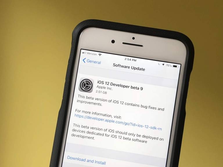 2018 rồi, nhưng Android vẫn thua kém iPhone ở những điểm này 2