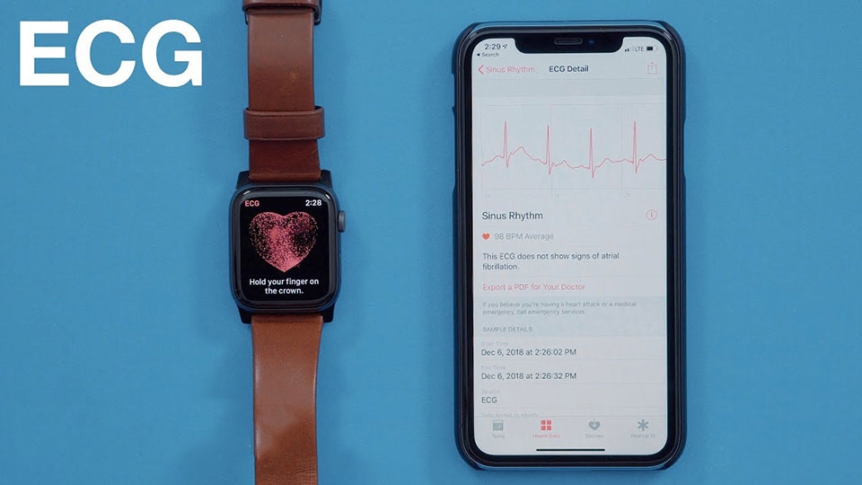 Trải nghiệm tính năng ECG trên Apple Watch Series 4