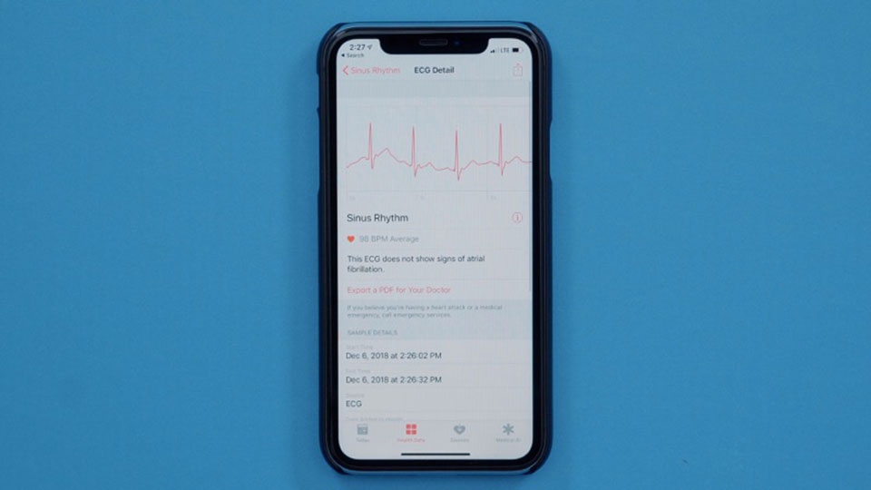 Trải nghiệm tính năng ECG trên Apple Watch Series 4