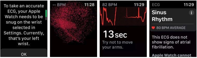 ứng dụng Apple Watch 01