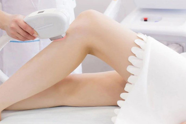 Xung máy triệt lông là gì 5