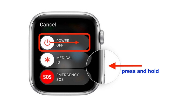 Apple Watch không gọi được - ảnh 1