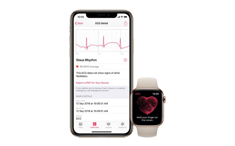Apple Watch Series 11 cung cấp tính năng đo điện tâm đồ
