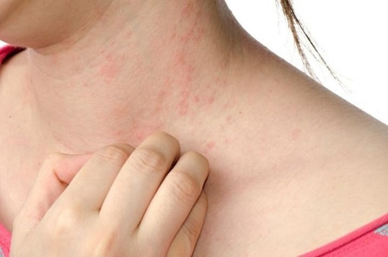 Bột hạnh nhân là gì? (hình 10)