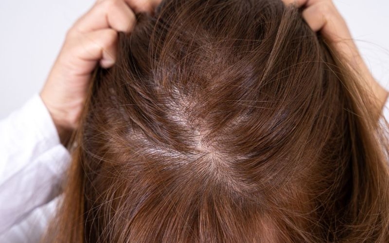 Các kiểu tóc giúp tóc trông dày hơn hình 1