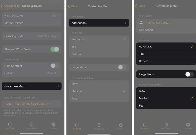 Tùy chỉnh menu AssistiveTouch trên Apple Watch