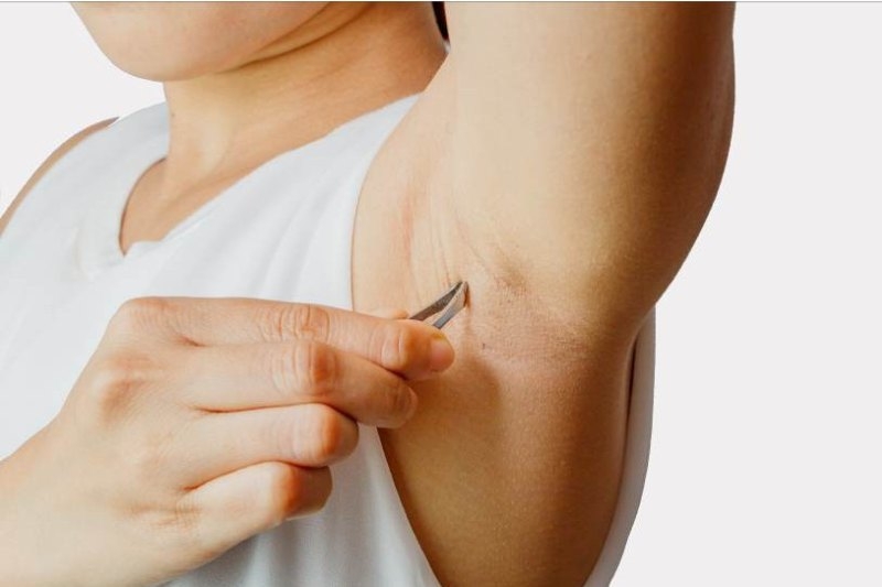 cách triệt lông tại nhà 1
