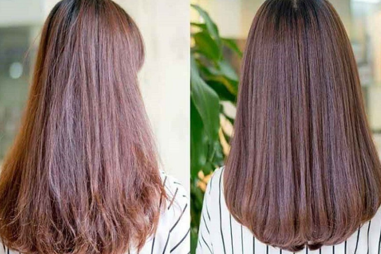 Có nên đi phục hồi tóc không 4