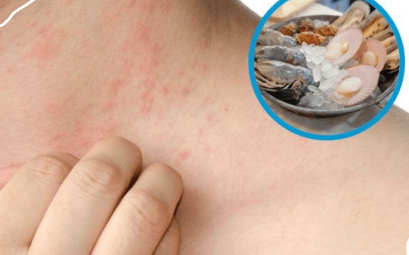 Tác dụng phụ của hải sâm gai vàng
