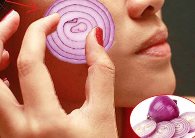 Hành tây bao nhiêu calo? (hình 12)