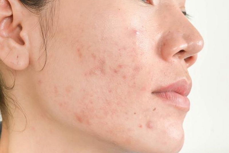 Hạt hướng dương bao nhiêu calo? (hình 6)