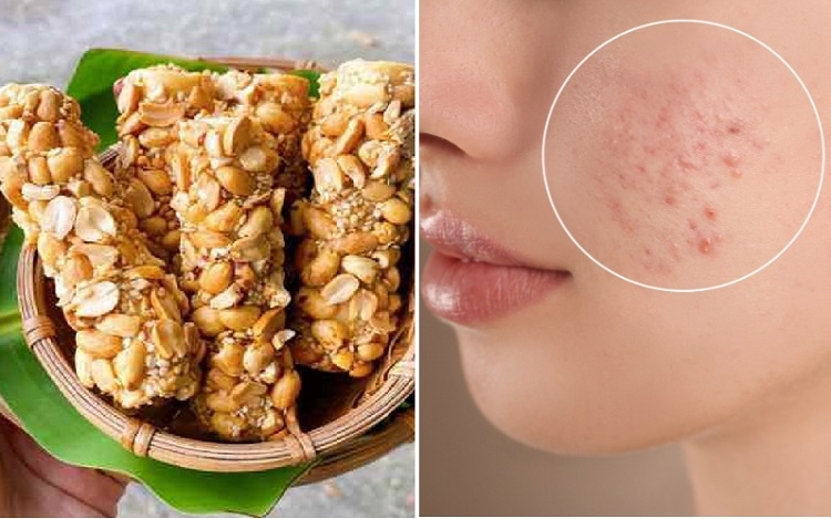 Kẹo đậu phộng bao nhiêu calo? (Hình 4)