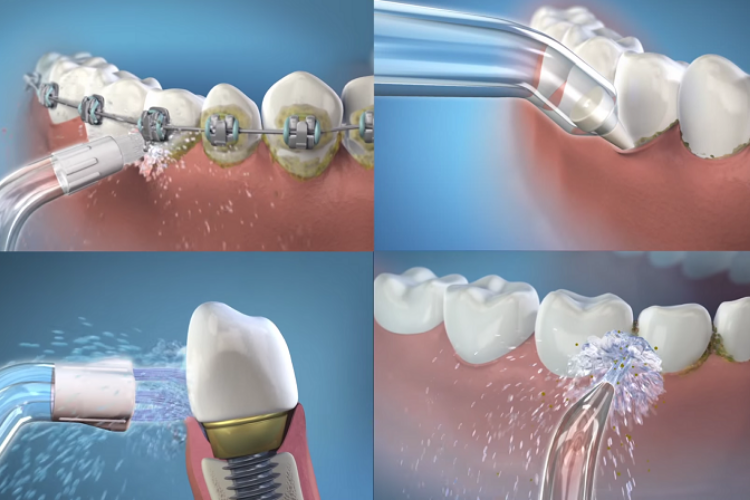 máy tăm nước dùng pin hay điện tốt hơn 1